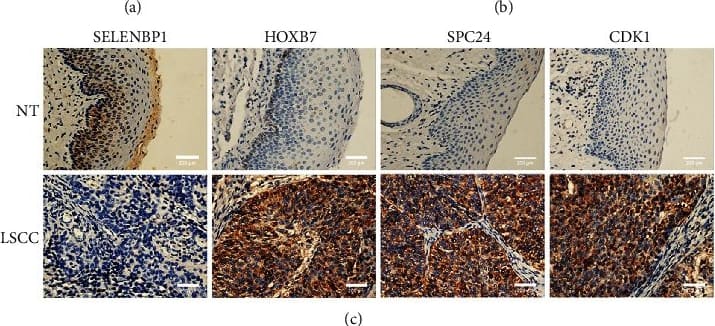 Differences in protein expression of four hub genes. (a) Western blot analysis was performed to quantify the protein expression of SELENBP1, HOXB7, SPC24, and CDK1 in the LSCC and NT groups. (b) Protein levels were normalized to  beta -actin. Quantification of protein levels such as those in (a) is shown in (b). (c) Representative immunostaining of SELENBP1, SPC24, HOXB7, and CDK1 in LSCC and NT groups. All magnification 400x. Each data was presented as mean +/- SEM (n ≥ 6/group). ∗∗∗∗P < 0.0001 versus the NT group. Image collected and cropped by CiteAb from the following open publication (//pubmed.ncbi.nlm.nih.gov/36718148), licensed under a CC-BY license. Not internally tested by Novus Biologicals.