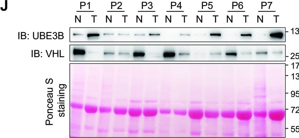 Western Blot UBE3B Antibody - BSA Free