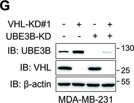 VHL inhibits the UBE3B-mediated tumorigenic potential of breast cancer cells.A Protein levels of Flag-VHL and Myc-UBE3B in the stable MDA-MB-231 cell line expressing Flag-VHL or Myc-UBE3B. B The cell proliferation rate was measured in the indicated MDA-MB-231 cells (mean +/- SD, n = 3). ****P < 0.0001, by 2-way ANOVA Tukey’s multiple comparisons test. hrs, hours. C, D Colony formation was conducted in the indicated MDA-MB-231 cells, and representative images from three experiments were shown in (C). Colony numbers (D) were quantified (mean +/- SD, n = 3). ****P < 0.0001, by 1-way ANOVA Tukey’s multiple comparisons test. E, F Invasion assays were carried out in the indicated MDA-MB-231 cells, and representative images from three experiments were shown in (E). Invaded cell numbers were quantified in (F) (mean +/- SD, n = 3). ****P < 0.0001, by 1-way ANOVA Tukey’s multiple comparisons test. G Protein levels of VHL and UBE3B were detected in control, VHL-KD#1, UBE3B-KD, and VHL- and UBE3B-double knockdown (VHL-KD#1 + UBE3B-KD) MDA-MB-231 cells. H Proliferation rate of control, VHL-KD#1, UBE3B-KD, and VHL-KD#1+UBE3B-KD MDA-MB-231 cells (mean +/- SD, n = 3). ****P < 0.0001, by 2-way ANOVA Tukey’s multiple comparisons test. hrs, hours. I–L Colony formation (I, J) and invasion (K, L) assays were performed in control, VHL-KD#1, UBE3B-KD, and VHL-KD#1+UBE3B-KD MDA-MB-231 cells, and the representative images from three experiments were shown. Colony numbers (J) and invaded cell numbers (L) were quantified (mean +/- SD, n = 3). ****P < 0.0001, by 1-way ANOVA Tukey’s multiple comparisons test. Scale bars: 100 μm. EV, empty vector. Image collected and cropped by CiteAb from the following open publication (//pubmed.ncbi.nlm.nih.gov/38914543), licensed under a CC-BY license. Not internally tested by Novus Biologicals.