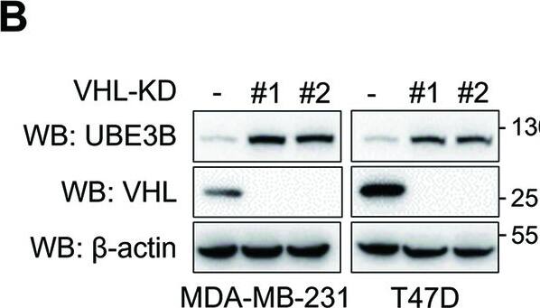 VHL decreases UBE3B protein levels in breast cancer cells.A Protein levels of endogenous UBE3B were assessed in MDA-MB-231 and T47D cells stably expressing either wild-type (WT) or catalytically inactive (Y112H) Flag-VHL. B Protein levels of endogenous UBE3B in control or VHL-knockdown (VHL-KD) MDA-MB-231 and T47D cells. C–F The half-life of UBE3B protein in MDA-MB-231 (C, D) or T47D (E, F) cells expressing Flag-VHL. Cells were treated with 10 μg/mL CHX for the indicated time (mean +/- SD, n = 3). ****P < 0.0001, by 2-way ANOVA Tukey’s multiple comparisons test. G–J The half-life of UBE3B protein was analyzed in scrambled shRNA (SC) or VHL-KD MDA-MB-231 (G, H) or T47D (I, J) cells. Cells were treated with 10 μg/mL CHX for the indicated time (mean +/- SD, n = 3). ****P < 0.0001, by 2-way ANOVA Tukey’s multiple comparisons test. K, L UBE3B protein levels in Flag-VHL-expressing MDA-MB-231 (K) and T47D (L) cells with or without MG132 treatment. EV, empty vector. Image collected and cropped by CiteAb from the following open publication (//pubmed.ncbi.nlm.nih.gov/38914543), licensed under a CC-BY license. Not internally tested by Novus Biologicals.