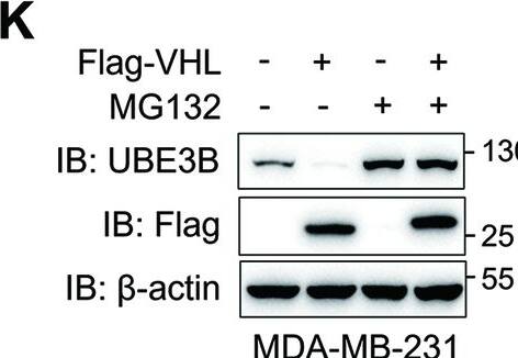 VHL decreases UBE3B protein levels in breast cancer cells.A Protein levels of endogenous UBE3B were assessed in MDA-MB-231 and T47D cells stably expressing either wild-type (WT) or catalytically inactive (Y112H) Flag-VHL. B Protein levels of endogenous UBE3B in control or VHL-knockdown (VHL-KD) MDA-MB-231 and T47D cells. C–F The half-life of UBE3B protein in MDA-MB-231 (C, D) or T47D (E, F) cells expressing Flag-VHL. Cells were treated with 10 μg/mL CHX for the indicated time (mean +/- SD, n = 3). ****P < 0.0001, by 2-way ANOVA Tukey’s multiple comparisons test. G–J The half-life of UBE3B protein was analyzed in scrambled shRNA (SC) or VHL-KD MDA-MB-231 (G, H) or T47D (I, J) cells. Cells were treated with 10 μg/mL CHX for the indicated time (mean +/- SD, n = 3). ****P < 0.0001, by 2-way ANOVA Tukey’s multiple comparisons test. K, L UBE3B protein levels in Flag-VHL-expressing MDA-MB-231 (K) and T47D (L) cells with or without MG132 treatment. EV, empty vector. Image collected and cropped by CiteAb from the following open publication (//pubmed.ncbi.nlm.nih.gov/38914543), licensed under a CC-BY license. Not internally tested by Novus Biologicals.
