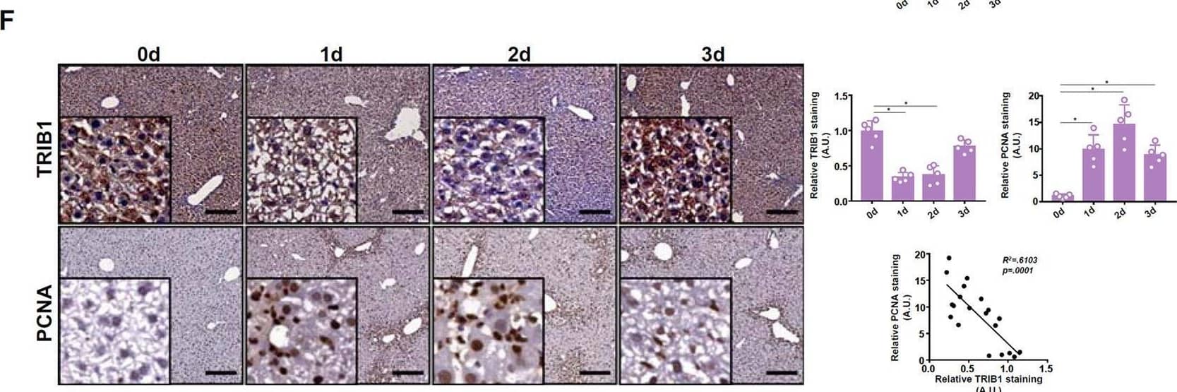 Trib1 expression was downregulated during the early phase of liver regeneration.A–C C57B6/L mice were subjected to partial hepatectomy (2/3 PHx) and sacrificed at indicated time points. Trib1 expression was examined by qPCR, western blotting, and immunohistochemical staining. N = 5 mice for each group. D–F C57B6/L mice were injected with acetaminophen (APAP, 300 mg/kg) and sacrificed at indicated time points. Trib1 expression was examined by qPCR, western blotting, and immunohistochemical staining. N = 5 mice for each group. G, H Primary murine hepatocytes were treated with HGF and harvested at indicated time points. Trib1 expression was examined by qPCR and western blotting. N = 3 biological replicates. Data are expressed as mean +/- S.D. *p < 0.05, one-way ANOVA with post-hoc Scheff´e. Image collected and cropped by CiteAb from the following open publication (//pubmed.ncbi.nlm.nih.gov/37355685), licensed under a CC-BY license. Not internally tested by Novus Biologicals.