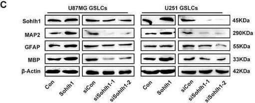 Sohlh1 promotes the differentiation of GSLCs. (A) U87MG and U251 GSLCs were cultured in medium containing 1% serum for 8 h. Representative images of induced differentiation of Sohlh1 overexpression and Sohlh1 knockdown in U87MG and U251 GSLCs. Scale bars indicate 100 μm. q‐PCR (B) and Western‐blot (C, D) were performed to detect the expression of GSLC differentiation‐related genes, including MAP2, GFAP and MBP. (E, F) Representative IF images of MAP2 and GFAP in differentiated spheroids of Sohlh1 overexpression and Sohlh1 knockdown in U87MG and U251 GSLCs. Scale bars indicate 100 μm. Statistical results were calculated using a two‐tailed Student's t test. *p < 0.05, **p < 0.01, ***p < 0.001. Image collected and cropped by CiteAb from the following open publication (//pubmed.ncbi.nlm.nih.gov/40418209), licensed under a CC-BY license. Not internally tested by Novus Biologicals.