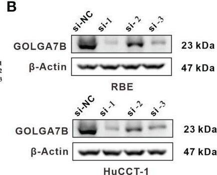 Identification of the biological functions of GOLGA7B and AGAP2−AS1 in CCA. (A) Knockdown of GOLGA7B and AGAP2−AS1 in RBE and HuCCT-1 cells was confirmed at the mRNA level by qRT-PCR. (B) Knockdown of GOLGA7B in RBE and HuCCT-1 cells was confirmed at the protein level by Western blotting. (C) The CCK-8 assay verified the proliferation of RBE and HuCCT-1 cells after GOLGA7B and AGAP2−AS1 depletion. (D) Transwell assays were performed to measure the migration and invasion capabilities of RBE and HuCCT-1 cells after GOLGA7B and AGAP2−AS1 depletion. ** P<0.01; *** P<0.001. Image collected and cropped by CiteAb from the following open publication (//pubmed.ncbi.nlm.nih.gov/36591499), licensed under a CC-BY license. Not internally tested by Novus Biologicals.