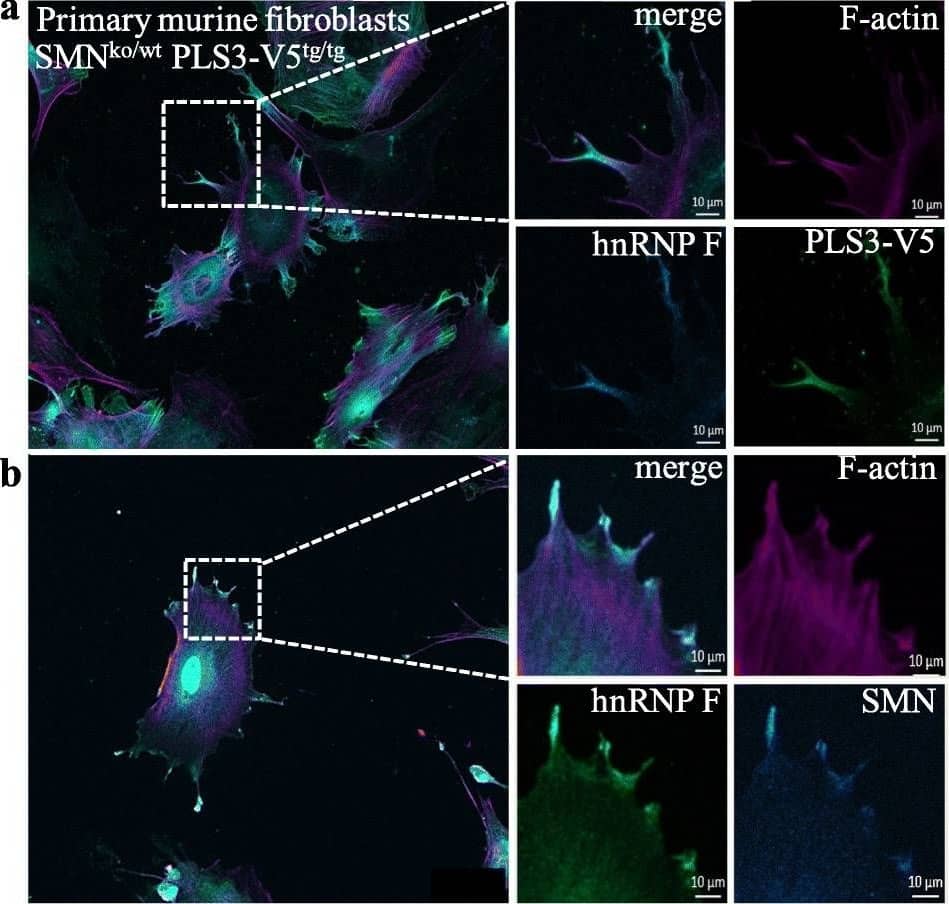 Immunocytochemistry/immunofluorescence: hnRNP F Antibody [NBP1-57273] - hnRNP F localizes with SMN and PLS3 in fibroblasts and motor neuron processes. Murine embryonic fibroblasts’ (MEFs) cell cultures were derived from Smn +/-; PLS3V5 tg/tg embryos and stained with V5 for PLS3 transgene; hnRNP-F, and F-actin with phalloidin. a) PLS3V5 localized to the same region as hnRNP F. b) hnRNP F similarly localized with SMN. Image collected and cropped by CiteAb from the following publication (//pubmed.ncbi.nlm.nih.gov/32938453/), licensed under a CC-BY license.