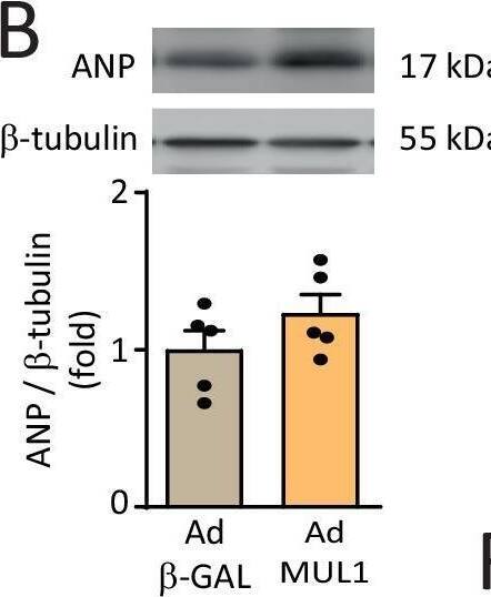 Role of MUL1 on the anti-hypertrophic effects of E2 in NE-treated cardiomyocytes.NRVMs were treated with Ad MUL1 or Ad  beta -GAL (control) with a MOI = 100 and incubated for 24 h. A MUL1 (N = 5) and B ANP (N = 5) protein levels were determined by western blotting.  beta -tubulin was used as a loading control. C MUL1 (N = 4) and D ANP (N = 3) mRNA levels were assessed by RT-qPCR. 18S RNA was used to normalize the data. The data correspond to the mean +/- SEM. Results were analyzed using a one-way ANOVA test followed by multiple Tukey’s comparisons. *p < 0.05, **p < 0.01. E NRVMs were stained with rhodamine-phalloidin (red) and nuclei with DAPI (blue). Confocal images were obtained, and cell area was determined (N = 4). F MUL1 (N = 6) and G ANP (N = 6) mRNA levels were determined by RT-qPCR. 18S RNA was used to normalize the data. H NRVMs were stained with MTG (400 nM). Images were obtained by confocal microscopy and analyzed to determine the number of mitochondria per cell and the relative mitochondrial volume (N = 5). Scale bar = 20 μm. The values correspond to the mean +/- SEM. Each independent experiment is displayed as a dot in the graphs. Results were analyzed using 2-way ANOVA followed by multiple Tukey’s comparisons. *p < 0.05, **p < 0.01, ***p < 0.001, and ****p < 0.0001. Image collected and cropped by CiteAb from the following open publication (//pubmed.ncbi.nlm.nih.gov/39971924), licensed under a CC-BY license. Not internally tested by Novus Biologicals.