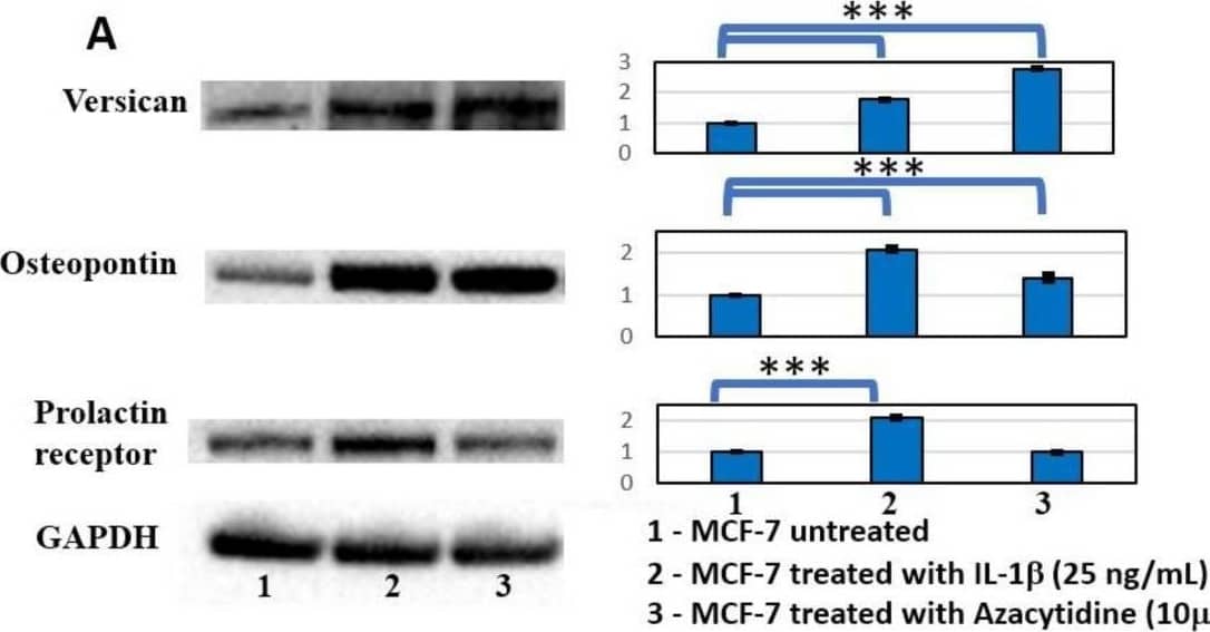 Western blot analysis of principal marker of bone homing. (A) Western blot analysis of Versican, Osteopontin, and Prolactin receptor in MCF-7 cells untreated and treated with IL-1 beta  and AZA after 48 h. Representative images of WB and densitometric analysis (Mean +/- SD) of Versican, Osteopontin, and Prolactin receptor. One-way ANOVA showed significant effect of treatment on densitometric data (p < 0.0005); significant differences were highlighted among tested treatments (p < 0.0005), except for Prolactin receptor with AZA (NS). (B) Western blot analysis of Versican, Osteopontin, and Prolactin receptor in MCF-7 cells untreated and treated with IL-1 beta  and Bobcat339 (33 uM and 75 uM) and relative co-treatments after 48 h. Representative images of WB and densitometric analysis (Mean +/- SD, n = 3) of Versican, Osteopontin, and Prolactin receptor. One-way ANOVA showed significant effect of treatment on densitometric data; significant differences among tested treatments versus untreated MCF-7 (*), and among IL-1 beta /BC co-treatments versus the IL-1 beta  one () are reported in the graphs (*** and , p < 0.0005). Image collected and cropped by CiteAb from the following open publication (//pubmed.ncbi.nlm.nih.gov/36499741), licensed under a CC-BY license. Not internally tested by Novus Biologicals.