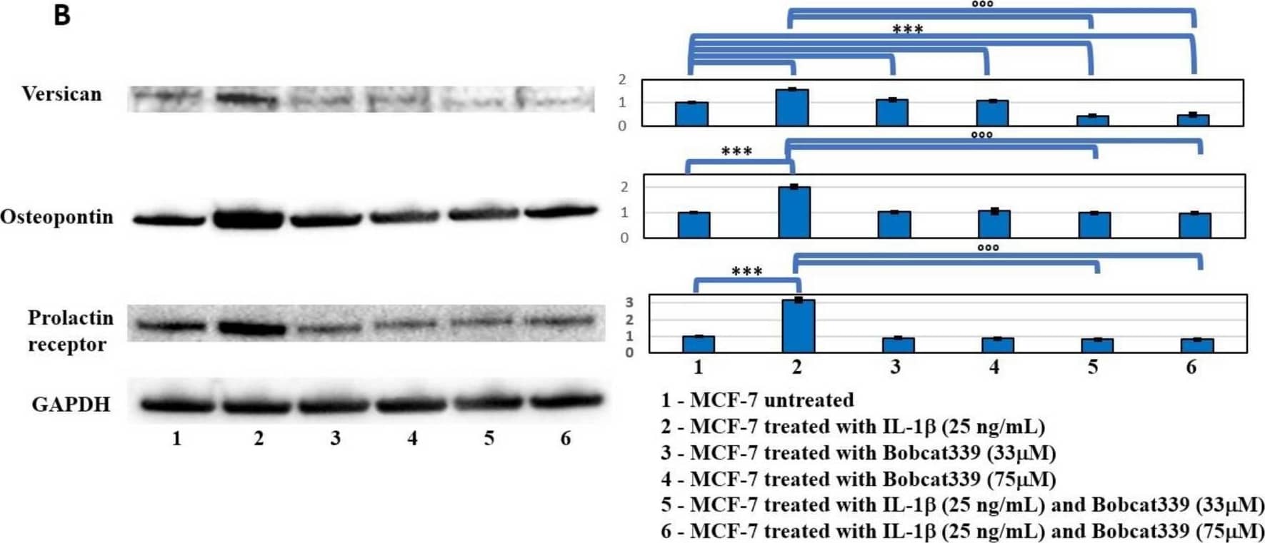 Western blot analysis of principal marker of bone homing. (A) Western blot analysis of Versican, Osteopontin, and Prolactin receptor in MCF-7 cells untreated and treated with IL-1 beta  and AZA after 48 h. Representative images of WB and densitometric analysis (Mean +/- SD) of Versican, Osteopontin, and Prolactin receptor. One-way ANOVA showed significant effect of treatment on densitometric data (p < 0.0005); significant differences were highlighted among tested treatments (p < 0.0005), except for Prolactin receptor with AZA (NS). (B) Western blot analysis of Versican, Osteopontin, and Prolactin receptor in MCF-7 cells untreated and treated with IL-1 beta  and Bobcat339 (33 uM and 75 uM) and relative co-treatments after 48 h. Representative images of WB and densitometric analysis (Mean +/- SD, n = 3) of Versican, Osteopontin, and Prolactin receptor. One-way ANOVA showed significant effect of treatment on densitometric data; significant differences among tested treatments versus untreated MCF-7 (*), and among IL-1 beta /BC co-treatments versus the IL-1 beta  one () are reported in the graphs (*** and , p < 0.0005). Image collected and cropped by CiteAb from the following open publication (//pubmed.ncbi.nlm.nih.gov/36499741), licensed under a CC-BY license. Not internally tested by Novus Biologicals.