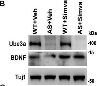 Western Blot: BDNF Antibody [NBP1-59304] - Simvastatin treatment increases BDNF expression in primary cortical neurons of AS mice. (A) Primary cultured cortical neurons prepared from wild type & AS embryos were treated with 5 μM simvastatin at DIV14 for 12 h. Neurons were then fixed & processed for double immunofluorescence staining using Ube3a & BDNF antibodies. Representative images were shown. About 12 immunostained neurons in each group were checked for BDNF expression, fluorescence intensity in each cell was quantified & compared. Scale bar, 50 μm. (B) Immunoblot analysis of matured BDNF levels in simvastatin treated primary cortical neurons as described above. (C) Band intensity of the mature BDNF was quantified & normalized to Tuj1 (BDNF/Tuj1). Values are mean ± SD; n = 3. The ‘a’ point P < 0.05 compared to vehicle treated wild type group & “b” denote P < 0.05 with respect to vehicle treated AS group (one way ANOVA with Holm–Sidak post hoc test). Image collected & cropped by CiteAb from the following publication (//pubmed.ncbi.nlm.nih.gov/31849603), licensed under a CC-BY license. Not internally tested by Novus Biologicals.