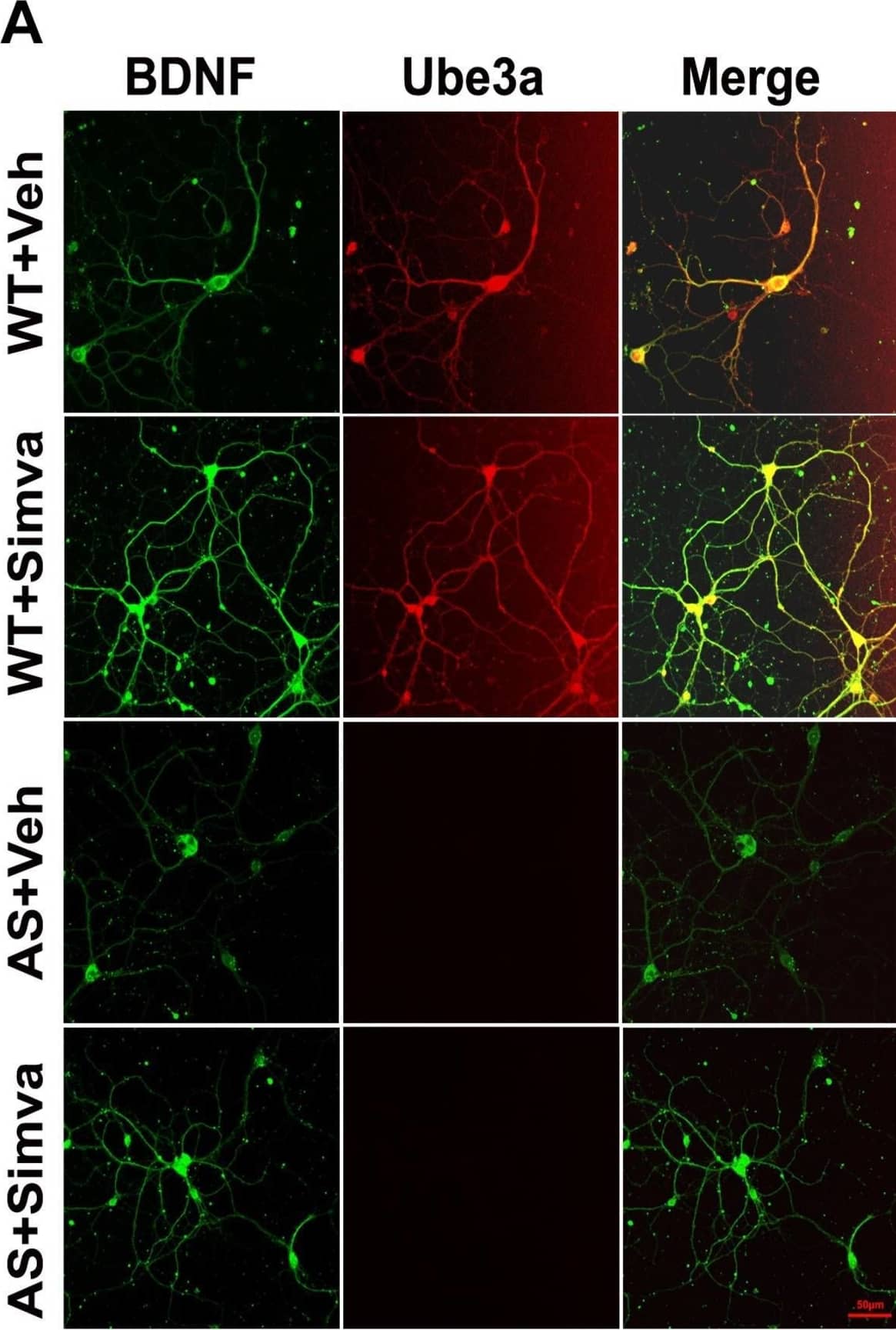 Simvastatin treatment increases BDNF expression in primary cortical neurons of AS mice. (A) Primary cultured cortical neurons prepared from wild type and AS embryos were treated with 5 μM simvastatin at DIV14 for 12 h. Neurons were then fixed and processed for double immunofluorescence staining using Ube3a and BDNF antibodies. Representative images were shown. About 12 immunostained neurons in each group were checked for BDNF expression, fluorescence intensity in each cell was quantified and compared. Scale bar, 50 μm. (B) Immunoblot analysis of matured BDNF levels in simvastatin treated primary cortical neurons as described above. (C) Band intensity of the mature BDNF was quantified and normalized to Tuj1 (BDNF/Tuj1). Values are mean +/- SD; n = 3. The ‘a’ point P < 0.05 compared to vehicle treated wild type group and “b