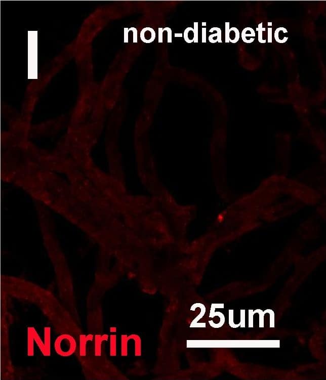 Immunocytochemistry/ Immunofluorescence: Norrin/NDP Antibody [NBP1-59305] - Staining of vascular BM whole mounts with antibodies to proteins detected in the proteome analysis.A generic staining of the vascular BMs was given by an antibody to the 7S domain of collagen IV  alpha 3 (A, C, E, F, G). Prominent staining for microvascular aneurisms was detected by staining with antibodies to C9 (B, C), Fibronectin (FN, E), ApoE (F) & PRELP (G). The same treatment of vascular BM whole mounts from non-diabetic eyes did not show staining for these proteins (D). A norrin-specific staining is shown to be generic for the entire vascular BM whole mounts (H), the signal, however, being less prominent in vascular aneurisms (arrow in H). Staining of vascular BM whole mounts from non-diabetic eyes showed a clearly weaker staining for norrin, when compared to vascular whole mounts from non-diabetic donors. Bar: 25um. Image collected & cropped by CiteAb from the following publication (//dx.plos.org/10.1371/journal.pone.0189857), licensed under a CC-BY license. Not internally tested by Novus Biologicals.