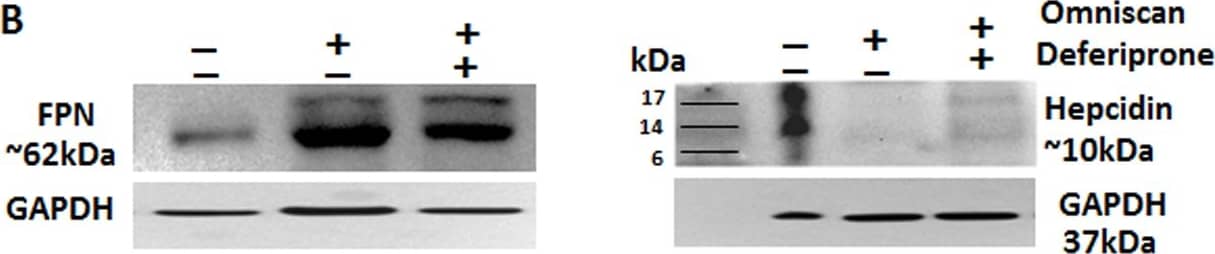 Omniscan-induced cells express iron metabolism proteins.(A) Expression of ferroportin and other iron regulatory protein hepcidin by human PBMC treated with 0.5 mM Omniscan and deferiprone for 8 days, as shown by immunocytochemistry staining. Representative images are shown. Deferiprone treatment significantly decreased Omniscan-induced ferroportin expression as shown by western blot analysis (B) left panel. After Omniscan treatment, hepcidin expression was decreased in comparison to untreated cells (A) lower panels, (B) right panels, western blot. Omniscan treatment with deferiprone increased the expression slightly. Representative blots from 3 separate experiments are shown. Values are means +/-SD, obtained from 3 separate experiments, Significance of the data was determined by ANOVA, followed by paired-group comparisons. **p <0.01, compared with control, *p <0.05 (for hepcidin), **p <0.01 (for ferroportin) deferiprone- and Omniscan-treated compared with Omniscan alone. (Scale bars 100 μm for all). Image collected and cropped by CiteAb from the following open publication (//pubmed.ncbi.nlm.nih.gov/26305890), licensed under a CC0-1.0 license. Not internally tested by Novus Biologicals.