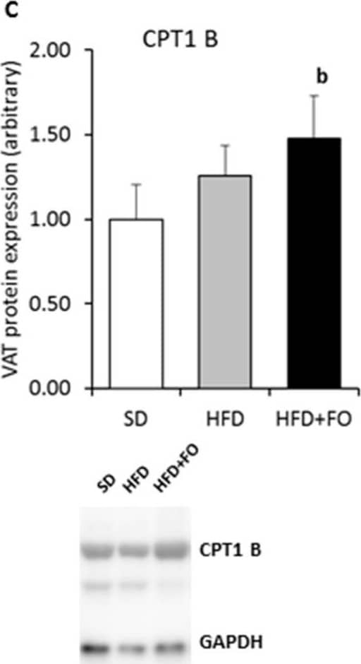 Western Blot CPT1B Antibody - BSA Free