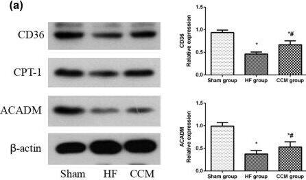CCM treatment regulates the key fatty acid metabolism factors in rabbits with HF. (a) Western blot analysis of the expressions of CD36, CPT-1, and ADAM. Densitometric analysis is shown in the bar graph. (b) Western blot analysis of the expression of ACC. Densitometric analysis is shown in the bar graph. Data are expressed as mean values +/- SD (*P < 0.05 compared with the sham group; #P < 0.05 compared with HF group). Image collected and cropped by CiteAb from the following open publication (//pubmed.ncbi.nlm.nih.gov/35799598), licensed under a CC-BY license. Not internally tested by Novus Biologicals.