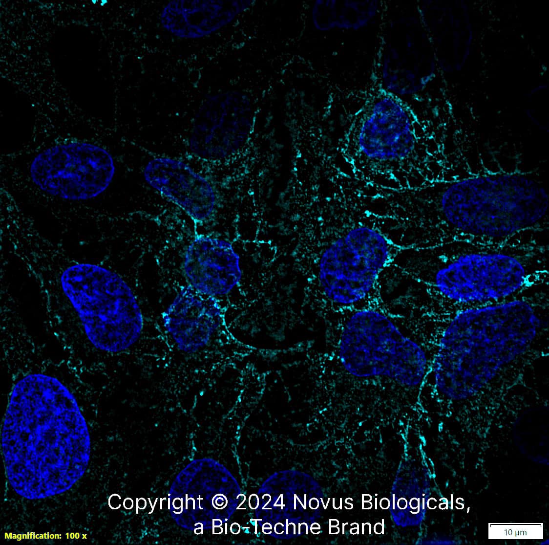 MCT1/SLC16A1 was detected in immersion fixed HepG2 human hepatocellular carcinoma cell line using Rabbit anti- MCT1/SLC16A1 Affinity Purified Polyclonal Antibody conjugated to Alexa Fluor® 647 (Catalog # NBP1-59656AF647) (light blue) at 10 µg/mL overnight at 4C. Cells were counterstained with DAPI (dark blue). Cells were imaged using a 100X objective and digitally deconvolved.