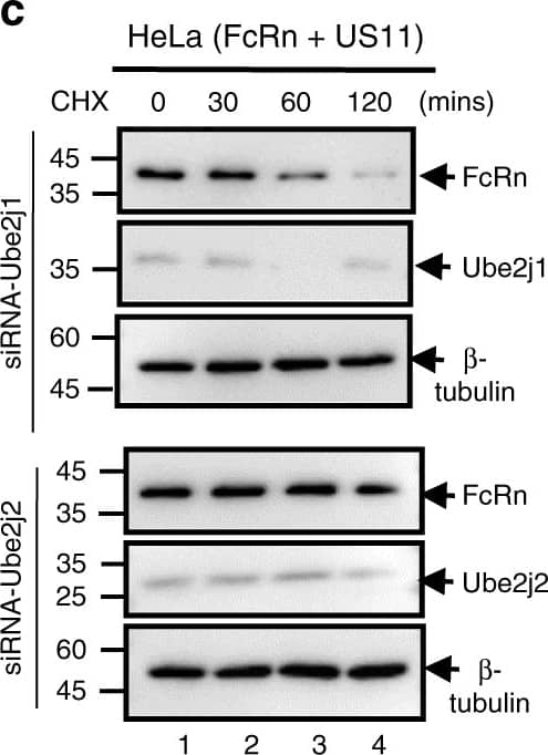 Western Blot UBE2J2/UBC6 Antibody