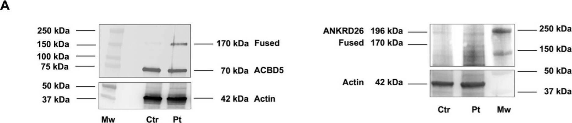 Western Blot ACBD5 Antibody - BSA Free