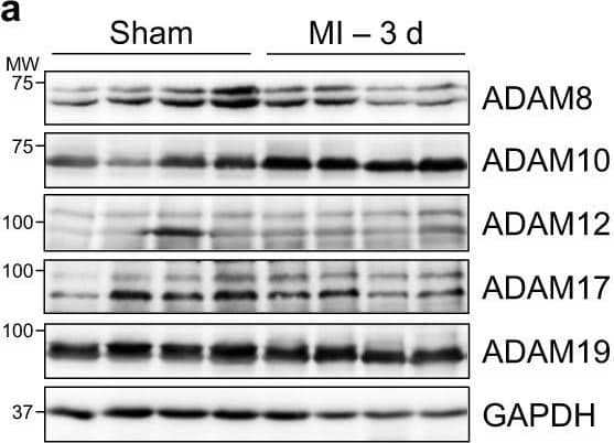 Western Blot ADAM19 Antibody