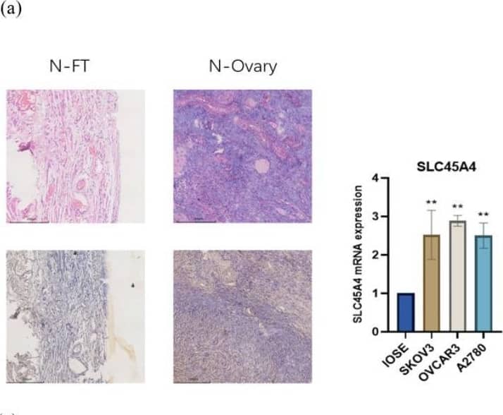 Immunohistochemistry SLC45A4 Antibody
