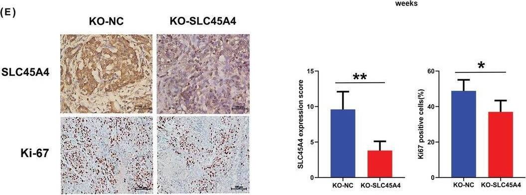 Immunohistochemistry SLC45A4 Antibody