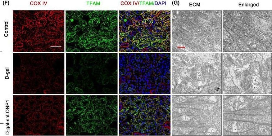 LONP1 overexpression ameliorates ageing‐related renal fibrosis and mitochondrial dysfunction in vivo. (A) Sirius red and IHC staining for FN, TFAM and Drp1 in the control, D‐gal and D‐gal + AAV‐LONP1 groups. The scale bars are 50 μm; (B, C) mtDNA and ATP contents in the control, D‐gal and D‐gal + AAV‐LONP1 groups; (D, E) protein levels of TFAM and Drp1 in the control, D‐gal and D‐gal + AAV‐LONP1 groups; (F) immunostaining for COX IV (red) and TFAM (green) and counterstaining with DAPI (blue) in the control, D‐gal and D‐gal + AAV‐LONP1 groups. The scale bar represents 50 μm. (G) Mitochondrial ultrastructure in the control, D‐gal and D‐gal + AAV‐LONP1 groups as determined by TEM. **p < 0.01 versus the D‐gal group by one‐way ANOVA. LONP1, lon protease 1; IHC, immunohistochemistry; FN, fibronectin; TFAM, transcription factor A, mitochondrial; Drp1, dynamin related protein 1; mtDNA, mitochondrial DNA; AAV, adeno‐associated virus; COX, cytochrome c oxidase; DAPI, 4′,6‐diamidino‐2‐phenylindole; IF, immunofluorescent; ANOVA, analysis of variance. Image collected and cropped by CiteAb from the following open publication (//pubmed.ncbi.nlm.nih.gov/39261902), licensed under a CC-BY license. Not internally tested by Novus Biologicals.