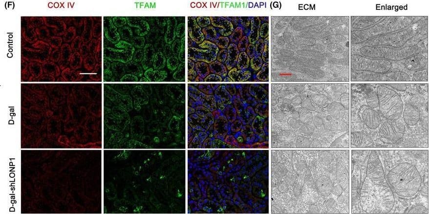 Silencing of LONP1 aggravates ageing‐related renal fibrosis and mitochondrial dysfunction in vivo. (A) Sirius red and IHC staining for FN, TFAM and Drp1 in the control, D‐gal and D‐gal + AAV‐shLONP1 groups. The scale bars are 50 μm; (B, C) mtDNA levels and ATP content in the control, D‐gal and D‐gal + AAV‐shLONP1 groups; (D, E) protein levels of TFAM and Drp1 in the control, D‐gal and D‐gal + AAV‐shLONP1 groups; (F) immunostaining for COX IV (red) and TFAM (green) and counterstaining with DAPI (blue) in the control, D‐gal and D‐gal + AAV‐shLONP1 groups. The scale bar represents 50 μm. (G) Mitochondrial ultrastructure in the control, D‐gal and D‐gal + AAV‐shLONP1 groups as determined by TEM. **p < 0.01 versus the D‐gal group by one‐way ANOVA. LONP1, lon protease 1; IHC, immunohistochemistry; FN, fibronectin; TFAM, transcription factor A, mitochondrial; Drp1, dynamin related protein 1; mtDNA, mitochondrial DNA; AAV, adeno‐associated virus; COX, cytochrome c oxidase; DAPI, 4′,6‐diamidino‐2‐phenylindole; IF, immunofluorescent; SD, standard deviation; ANOVA, analysis of variance. Image collected and cropped by CiteAb from the following open publication (//pubmed.ncbi.nlm.nih.gov/39261902), licensed under a CC-BY license. Not internally tested by Novus Biologicals.