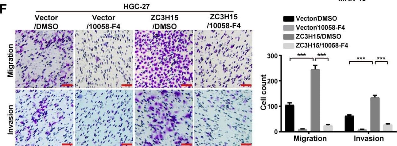 ZC3H15 promoted GC progression by increasing c-Myc expression.A GSEA enrichment plots of c-Myc target genes in high ZC3H15 expression versus low ZC3H15 expression TCGA GCs. Normalized enrichment score (NES), false discovery rate (FDR), and P-values were shown in the plot. B, C ZC3H15 modulated the protein and mRNA expression of c-Myc in HGC-27 and MKN-45 cells. D, E MTT assays were performed to examine the inhibitory effect of 10058-F4 (100 μM) on the cell proliferation of ZC3H15-overexpression HGC-27 and MKN-45 cells. F, G Transwell assays were performed to examine the inhibitory effect of 10058-F4 (100 μM) on the cell migration and invasion of ZC3H15-overexpression HGC-27 and MKN-45 cells. All data were expressed as mean +/- SD. Student’s t-test was performed to analyzed significance, *P < 0.05, **P < 0.01, ***P < 0.001. Image collected and cropped by CiteAb from the following open publication (//pubmed.ncbi.nlm.nih.gov/35064102), licensed under a CC-BY license. Not internally tested by Novus Biologicals.