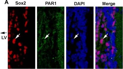 Immunocytochemistry/ Immunofluorescence: PAR1/Thrombin Receptor Antibody (N2-11) [NBP1-71770] - PAR1 is expressed by neural stem cells in the sub-ventricular zone (SVZ) of the adult mouse brain. Photomicrographs show immunofluorescence double-labeling for PAR1 with Sox2-positive (A), or PAR1 with Nestin-positive (C) multipotent neural stem cells (NSCs) within the lateral wall of the lateral ventricle (LV). RNAscope was used to identify cells expressing both PAR1 & Sox2 (B), or Nestin (D) RNA in NSCs of the adult SVZ. Arrow indicates an example of a double-labeled cell in each case, with arrowhead indicating a singly labeled cell (Scale bar = 10 μm). Boxed area in B & D is also shown at higher magnification to visualize double-labeled cells. (E) Histogram shows expression of PAR1 RNA was high in NSCs grown as neurospheres (NS), or when plated on poly-L-lysine coated coverslips as monolayers in stem cell media containing EGF & bFGF. PAR1 RNA expression by NSC monolayers decreased by 87% when EGF & bFGF were removed from the media for 7 DIV promoting stem cell differentiation. (F) Withdrawal of EGF & bFGF to induce NSC monolayer differentiation resulted in a parallel decrease in Nestin RNA expression. (**P < 0.01, ***P < 0.001 Students t-test). Image collected & cropped by CiteAb from the following publication (//pubmed.ncbi.nlm.nih.gov/29921916), licensed under a CC-BY license. Not internally tested by Novus Biologicals.