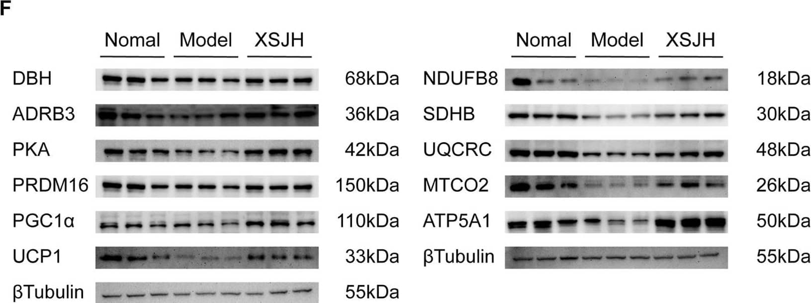 (A) PCA among in Normal, Model and XSJH groups; (B) OPLS-DA in the Model vs. Normal group and XSJH vs. Model group; (C) Differential metabolites among Normal group, Model group and XSJH group; (D) Differential KEGG enrichment pathways among Normal group, Model group and XSJH group; (E) The analysis of serum NA concentration; (F,G) Western blotting bands of DBH, ADRB3, PKA, thermogenic proteins and OXPHOS proteins in BAT tissues and quantitative analysis. Data are expressed as the mean +/- SD, n = 3–8 per group. *p < 0.05, **p < 0.01, versus Normal group; #p < 0.05, ##p < 0.01 versus Model group. Image collected and cropped by CiteAb from the following open publication (//www.frontiersin.org/articles/10.3389/fphar.2024.1371929/full), licensed under a CC-BY license. Not internally tested by Novus Biologicals.