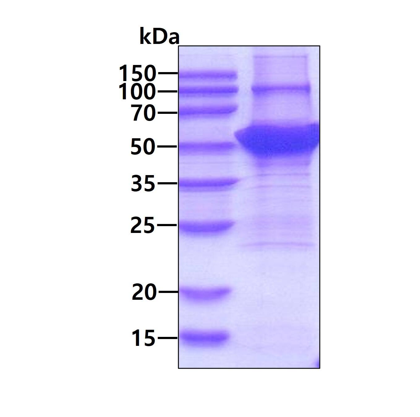 SDS-PAGE: Recombinant Human Cytokeratin 14 His Protein [NBP1-72467] - 3ug by SDS-PAGE under reducing condition and visualized by coomassie blue stain.