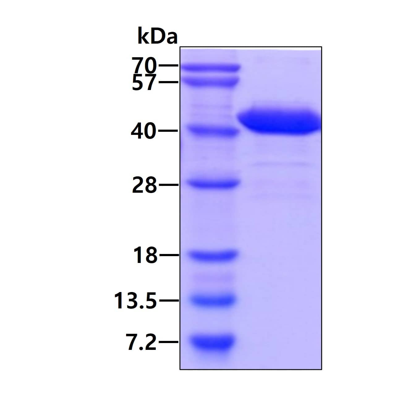 SDS-Page: Recombinant Human NAPG Protein [NBP1-72470] - 3ug by SDS-PAGE under reducing condition and visualized by coomassie blue stain.