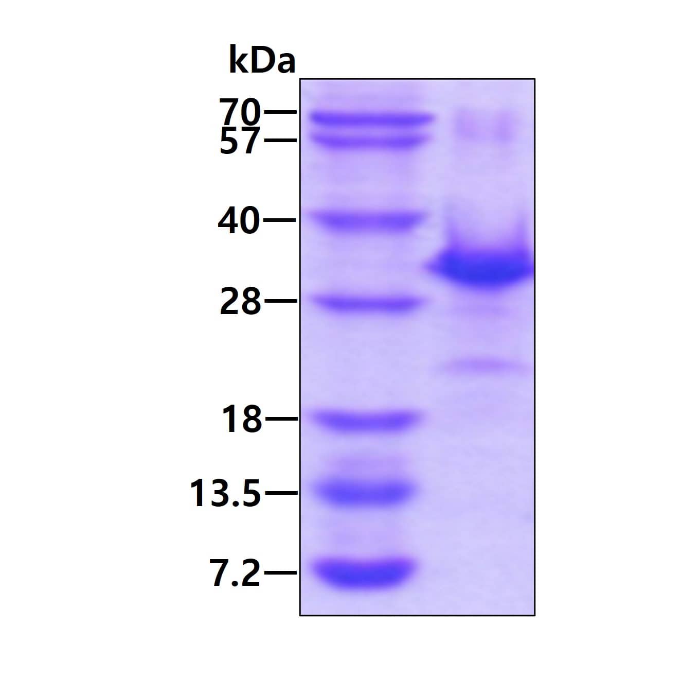 SDS-Page: Recombinant Human p27/Kip1 Protein [NBP1-72503] - 3ug by SDS-PAGE under reducing condition and visualized by coomassie blue stain.