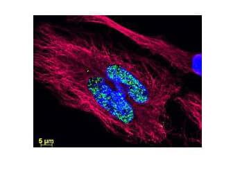 DyLight(TM) dyes can be used for multi-color immunofluorescence microscopy with uniform fluorescence intensity throughout the image. DyLight(TM) dyes are exceptionally bright and photostable and are optimized for microscopy and microarray detection methods. This image shows anti-histone detection using a DyLight(TM) 488 conjugate (green). Anti-Tubulin was detected using a DyLight(TM) 549 conjugate (red). Nuclei were counter-stained using DAPI (blue). The image was captured using an Axio Imager.Z1 (Zeiss Micro Imaging Inc).