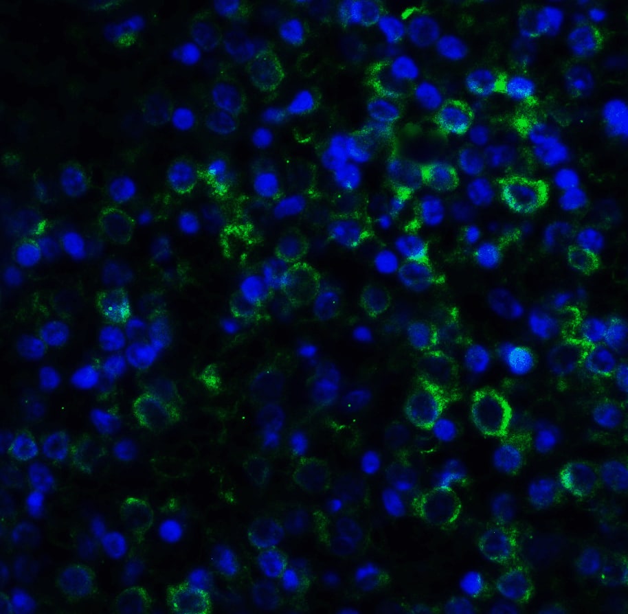 Immunocytochemistry/ Immunofluorescence: MD-2 Antibody (1A2E3) - BSA Free [NBP1-75513] - Immunofluorescence of MD-2 in human spleen with MD-2 Antibody at 20 u/ml.