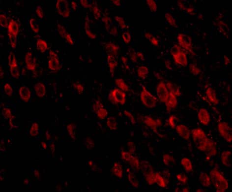 Immunocytochemistry/ Immunofluorescence: PD-1 Antibody (7A11B1) - BSA Free [NBP1-75518] - Immunofluorescence of PD-1 in mouse brain tissue with PD-1 antibody at 20 u/mL.