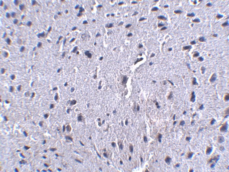 Immunohistochemistry: PD-1 Antibody (7A11B1) - BSA Free [NBP1-75518] - Immunohistochemistry of PD-1 in mouse brain tissue with PD-1 antibody at 2.5 u/mL.