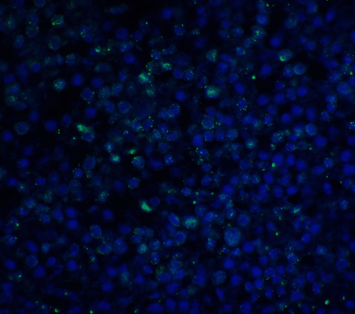 Immunocytochemistry/ Immunofluorescence: PD-1 Antibody (7A11B1) - BSA Free [NBP1-75518] - Immunofluorescence of PD-1 in human spleen tissue with PD-1 antibody at 20 u/ml.Green: PD-1 Antibody [7A11B1]   Blue: DAPI staining