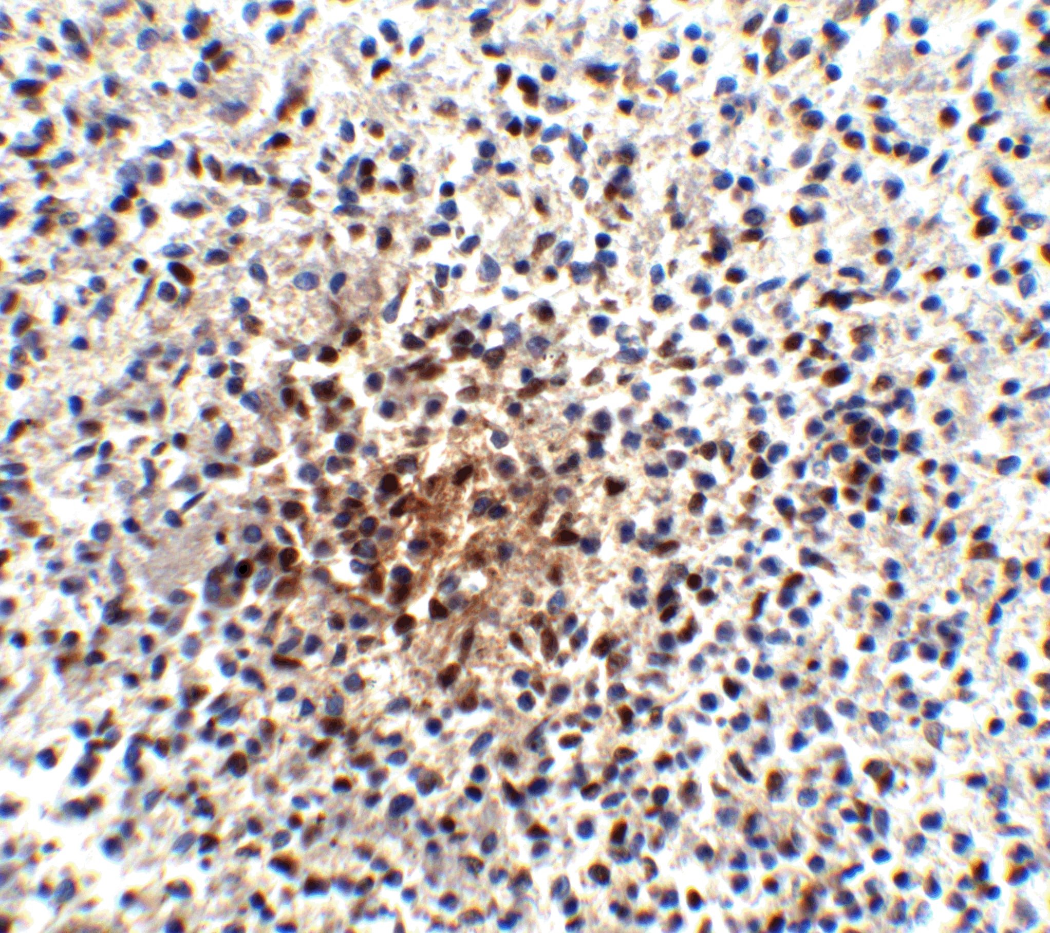 Immunohistochemistry: PD-1 Antibody (7A11B1) - BSA Free [NBP1-75518] - Immunohistochemistry of PD-1 in human spleen tissue with PD-1 antibody at 25 u/ml.