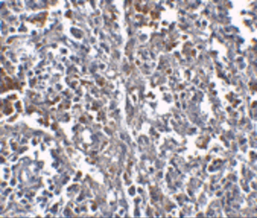 Immunohistochemistry: Orai1 Antibody (3F6H5) - BSA Free [NBP1-75522] - Immunohistochemistry of Orai1 in human spleen tissue with Orai1 antibody at 2.5 u/mL.