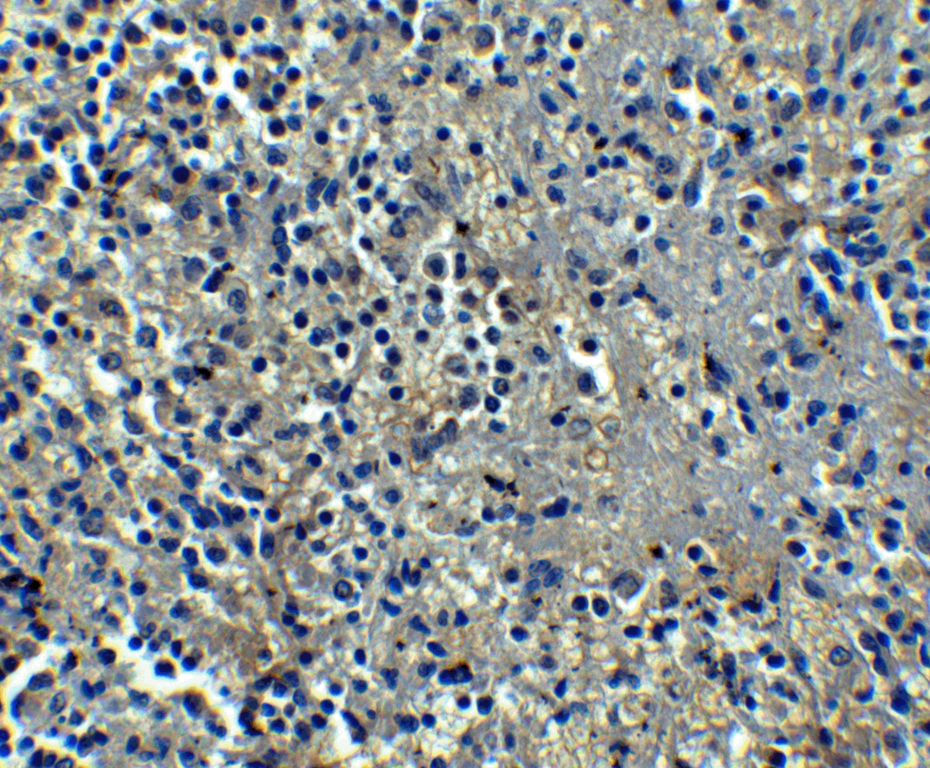 Immunohistochemistry: Orai1 Antibody (6D11A11) - BSA Free [NBP1-75523] - Immunohistochemistry of Orai1 in human spleen tissue with Orai1 antibody at 5 u/mL.