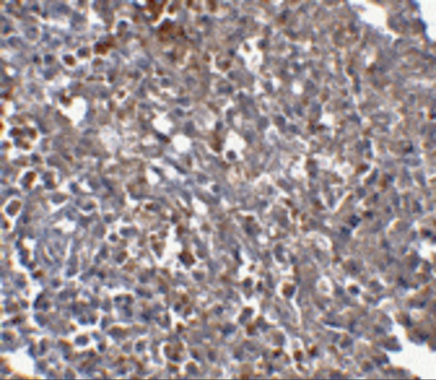 Immunohistochemistry: Orai1 Antibody (6D11A11) - BSA Free [NBP1-75523] - Immunohistochemistry of Orai1 in human spleen tissue with Orai1 antibody at 2.5 u/mL.