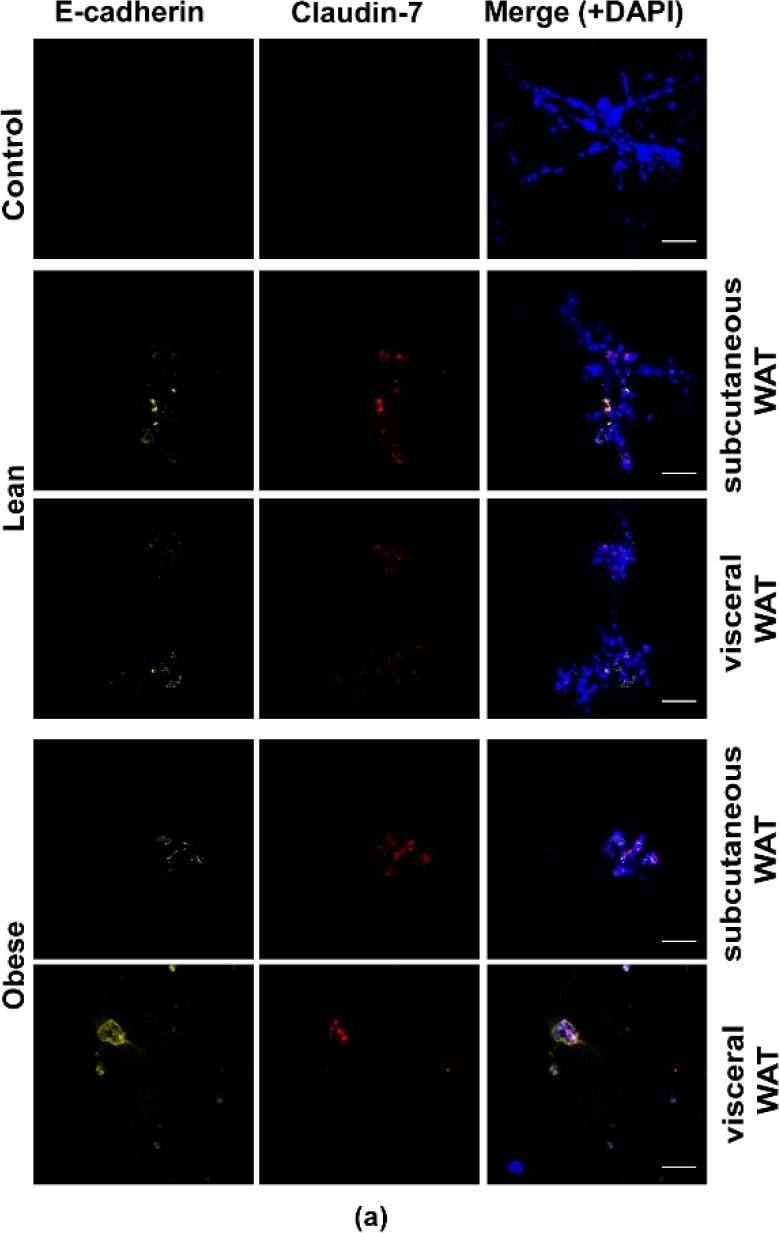 Immunocytochemistry/ Immunofluorescence: Donkey anti-Mouse IgG (H+L) Secondary Antibody [DyLight 594] (Pre-adsorbed) [NBP1-75617] - Mouse WAT-CM induces the expression of epithelial biomarkers in mesenchymal triple negative breast cancer cell line grown in a 3D culture. (a) Representative images of MDA-MB-231 cells cultured with or without lean or obese subcutaneous or visceral WAT-CM & co-stained for E-cadherin, claudin-7, & DAPI; scale bar = 100 µm. (b) & (c) are the relative expression of the respective markers, mean ± SEM (n = 6 biological replicates). The average protein expression from five images per replicate were normalized to DAPI & analyzed relative to the control cultures. Significance was determined by the Friedman test. If significant, Dunn’s test was used for further pairwise comparison; * p < 0.05. Image collected & cropped by CiteAb from the following publication (//pubmed.ncbi.nlm.nih.gov/32899433), licensed under a CC-BY license. Not internally tested by Novus Biologicals.