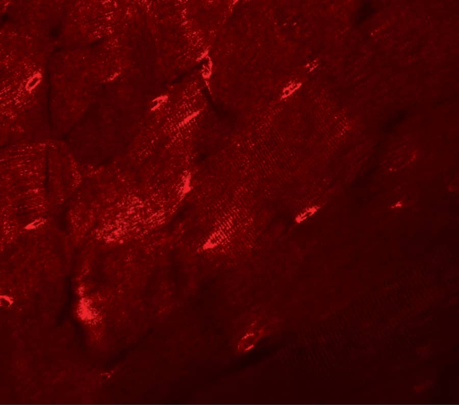 Immunocytochemistry/ Immunofluorescence TMEM38A Antibody - BSA Free