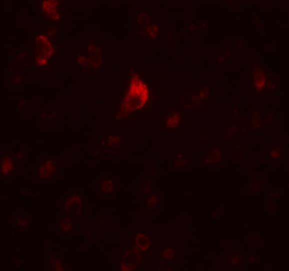 Immunocytochemistry/ Immunofluorescence: PICALM Antibody - BSA Free [NBP1-76254] - Immunofluorescence of PICALM in human brain tissue with PICALM antibody at 20 u/mL.