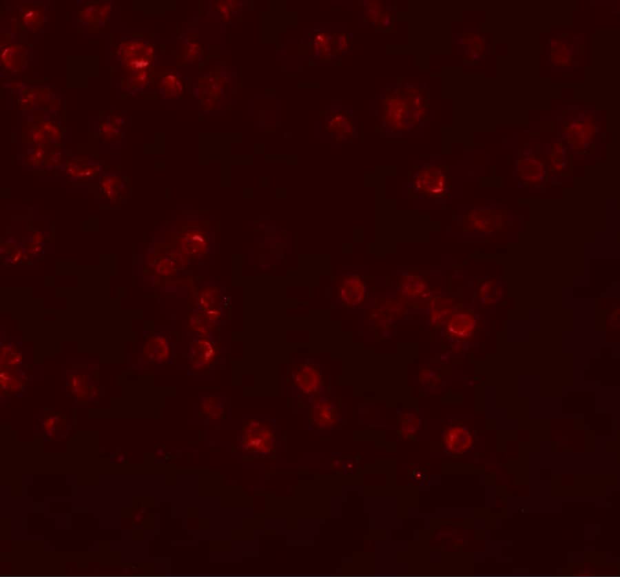 Immunocytochemistry/ Immunofluorescence: ANAPC13 Antibody - BSA Free [NBP1-76261] - Immunofluorescence of ANAPC13 in Jurkat cells with ANAPC13 antibody at 20 ug/mL.