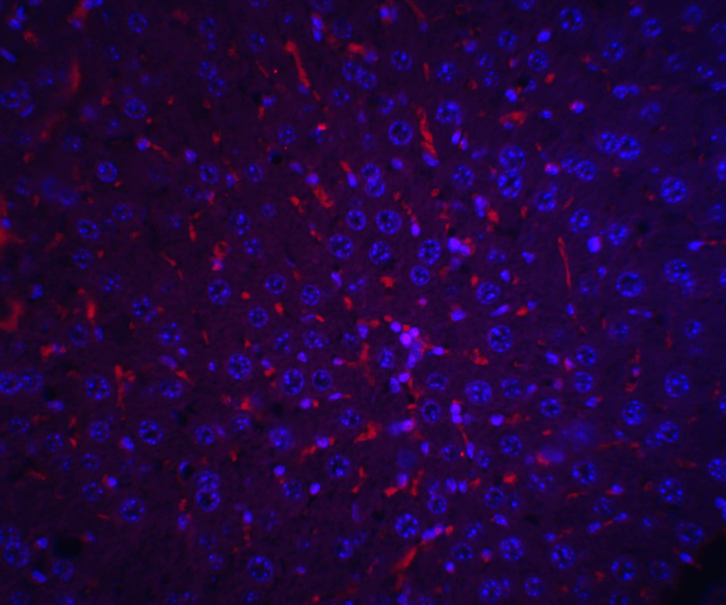 Immunocytochemistry/ Immunofluorescence: alpha-Fetoprotein/AFP Antibody - BSA Free [NBP1-76275] - Immunofluorescence of alpha-Fetoprotein/AFP in mouse liver tissue with alpha-Fetoprotein/AFP antibody at 20 u/mL.Red: alpha-Fetoprotein/AFP Antibody   Blue: DAPI staining