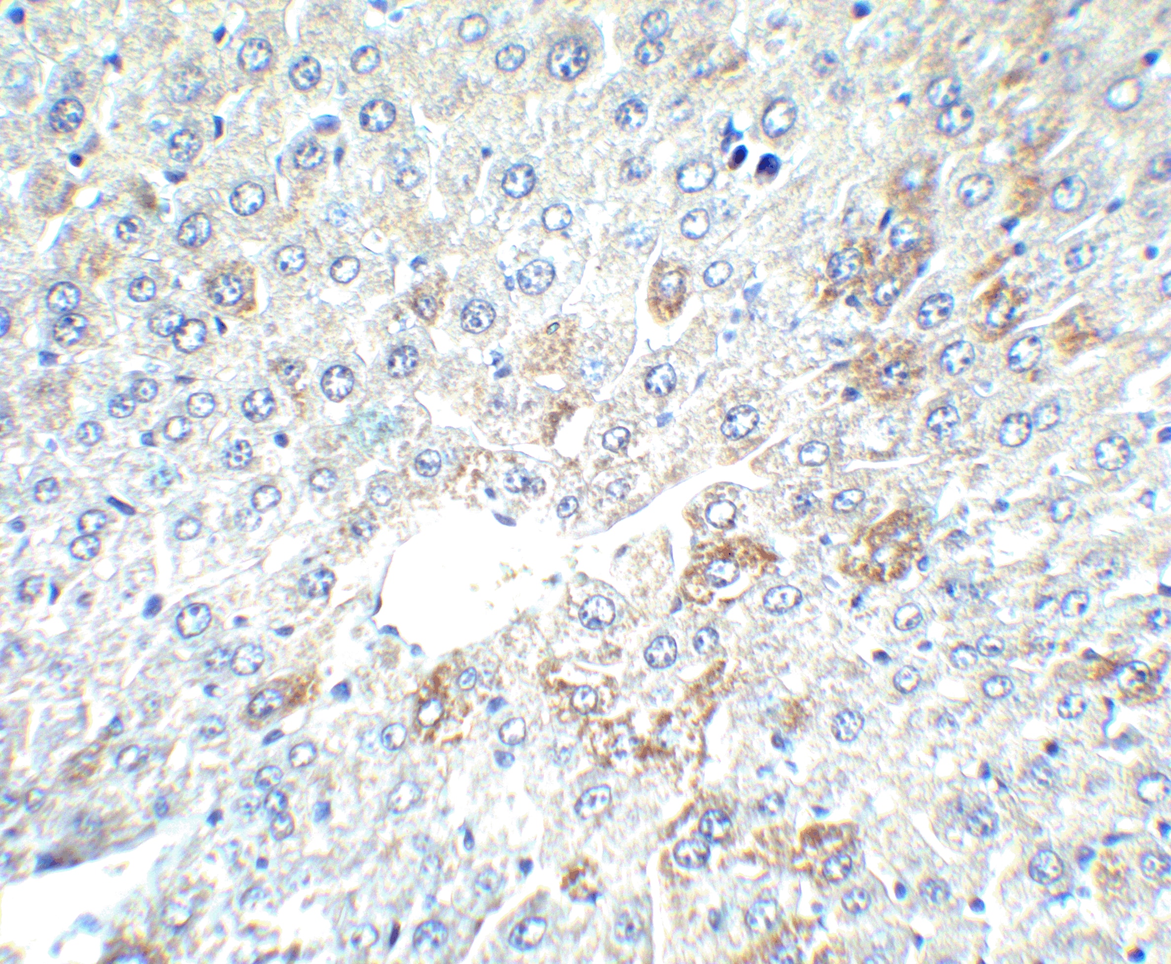 Immunohistochemistry: alpha-Fetoprotein/AFP Antibody - BSA Free [NBP1-76275] - Immunohistochemistry of alpha-Fetoprotein/AFP in mouse liver tissue with alpha-Fetoprotein/AFP antibody at 2.5 u/ml.