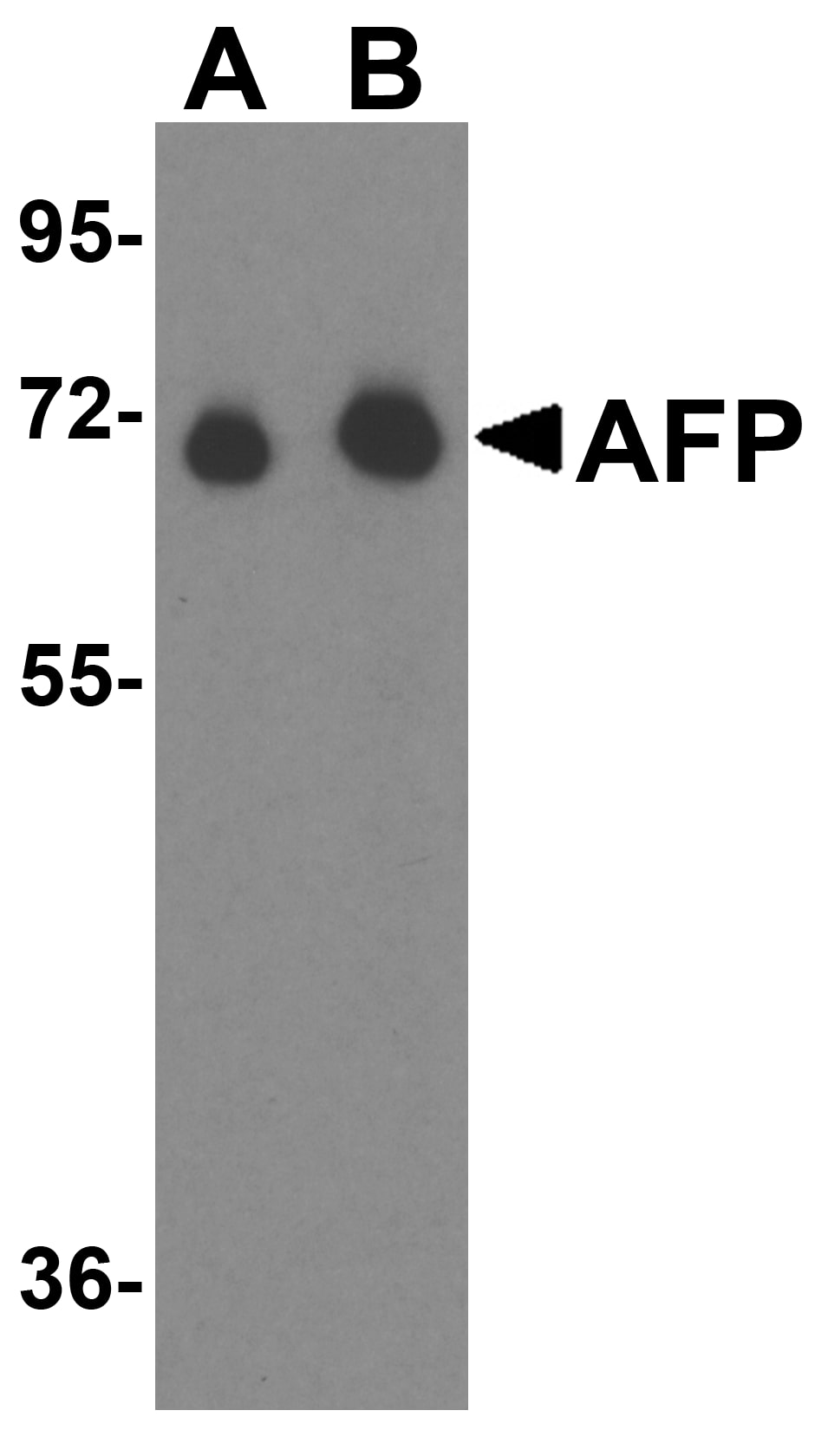 Western Blot: alpha-Fetoprotein/AFP Antibody - BSA Free [NBP1-76275] - Western blot analysis of alpha-Fetoprotein/AFP in fetal human liver tissue lysate with alpha-Fetoprotein/AFP antibody at (A) 1 u/mL and (B) 2 u/mL.