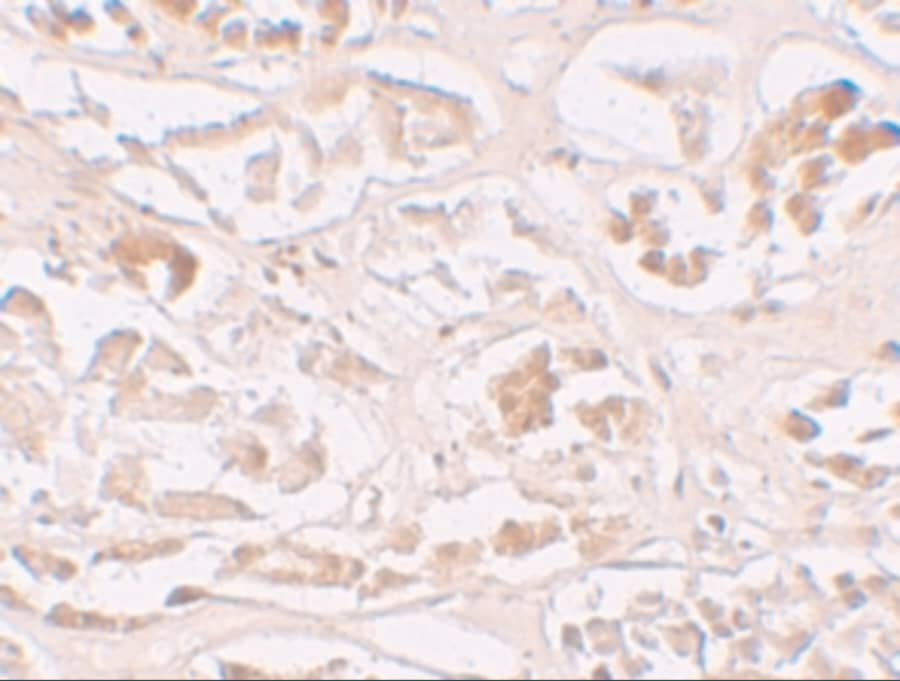 Immunohistochemistry: ABH2 Antibody - BSA Free [NBP1-76276] - Immunohistochemistry of ABH2 in human kidney tissue with ABH2 antibody at 10 u/mL.