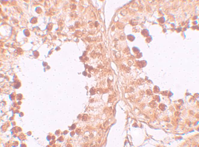 Immunohistochemistry: CRISP-2 Antibody - BSA Free [NBP1-76277] - Immunohistochemistry of CRISP-2 in human testis tissue with CRISP-2 antibody at 10 u/mL.